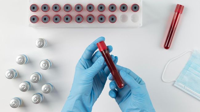 Ini Risiko Penyakit yang Bisa Diderita Berdasarkan Golongan Darah