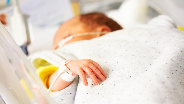Bayi Baru Lahir Kuning, Ketahui Penyebab dan Cara Mengatasinya