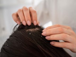 Cara Ampuh Hilangkan Telur Kutu Rambut Pakai Garam, Mudah & Murah