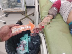 Tukang Ojek Ditemukan Penuh Luka di Paniai Diduga Dibacok OTK