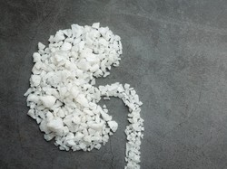 Ini Minuman Pagi Terbaik untuk Kesehatan Ginjal Menurut Ahli Gizi