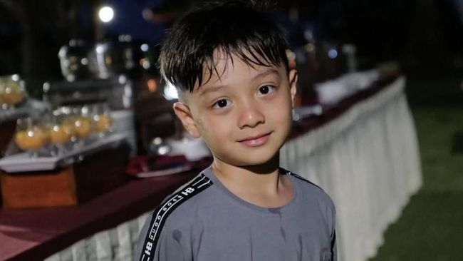 Drama Sunat Air Rumi Putra Irish Bella, Awalnya Berani Berujung Mewek