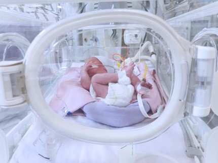 Cerita Bayi Baru Lahir Alami Patah Tulang Tengkorak & Perdarahan Otak