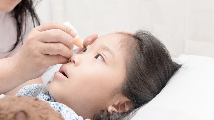 Penggunaan Obat Tetes Mata pada Anak Bisa Sebabkan Katarak&comma; Ini Penjelasan Dokter