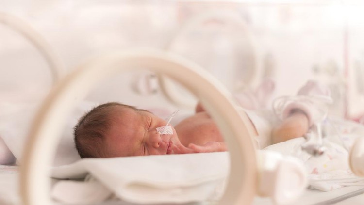 Bayi baru lahir dengan berat rendah berisiko stroke
