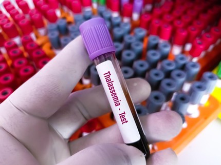 Risiko Thalasemia pada Anak Apakah Dapat Dicegah? Simak Penjelasannya Menurut Ahli