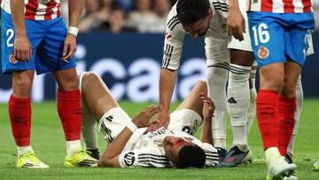 Berita Olahraga Terkini CNN Sport : Wajah Mbappe Sampai Berdarah, Madrid Ditahan Girona 1-1