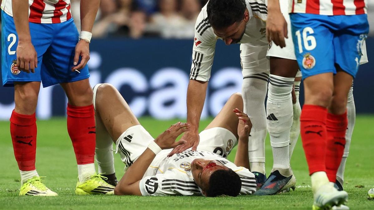 Wajah Mbappe Sampai Berdarah, Madrid Ditahan Girona 1-1