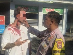 WNA Prancis Aniaya Pria Saat Olahraga di Gym Denpasar Barat