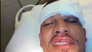 Sorotan Dunia Olahraga CNN Sport : Kondisi Wajah Pemain JDT Usai Pingsan Ditendang Pemain Al Ahli