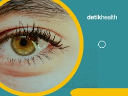 Video: Arah Tumbuh Bulu Mata Kebalik, Normal atau Kelainan?