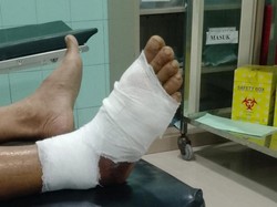 Pencari Rumput di Brebes Digigit Ular Berbisa Gibug, Begini Kondisinya