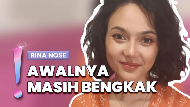 Video: Rina Nose Sempat Merasa Menyesal Meski Oplas Hidung Berhasil