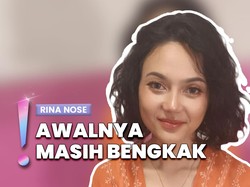 Video: Rina Nose Sempat Merasa Menyesal Meski Oplas Hidung Berhasil