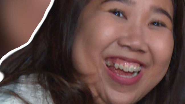 Video: Puji Perubahan Hidung Rina Nose, Kiky Saputri Kepikiran soal Oplas