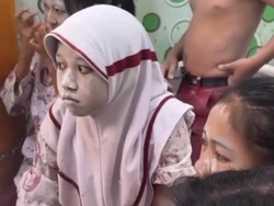 Belasan Siswa Gatal-gatal Usai Makan MBG, SPPG: Menu Sudah Pernah Disajikan