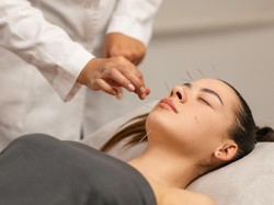 Tren Baru! Akupuntur Wajah Jadi Alternatif Botox Tanpa Suntik