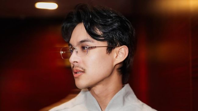 Rambut Rontok Parah, Rey Mbayang Rupanya Idap Autoimun Psoriasis