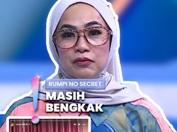 Video: Perubahan Hidung Disorot, Ria Ricis Akui Lakukan Rhinoplasty