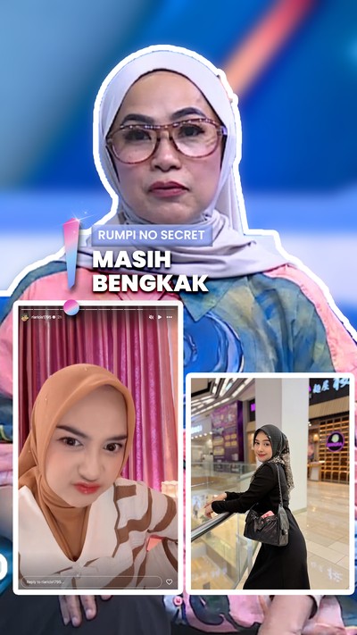 Video: Perubahan Hidung Disorot, Ria Ricis Akui Lakukan Rhinoplasty