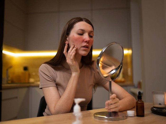 Pastikan selalu memilih skincare yang mengandung bahan menenangkan kulit seperti lidah buaya, niacinamide, chamomile, dan lain sebagainya. Bahan ini dapat mengurangi iritasi pada kulit wajah dengan sangat baik.