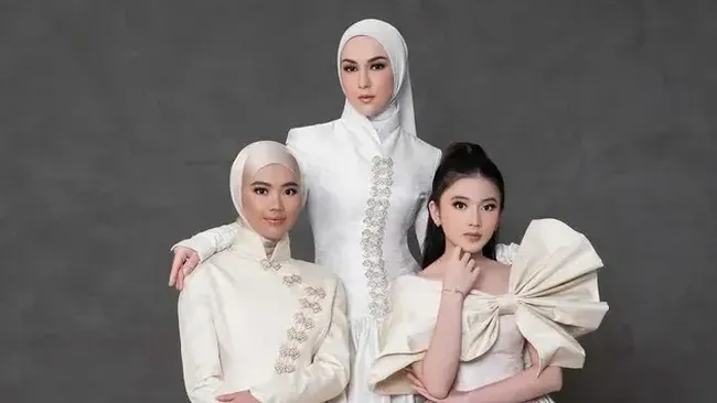 Anak Sambung Berprofesi Dokter, Irish Bella Ngaku Lebih Tenang dan Sering Konsul