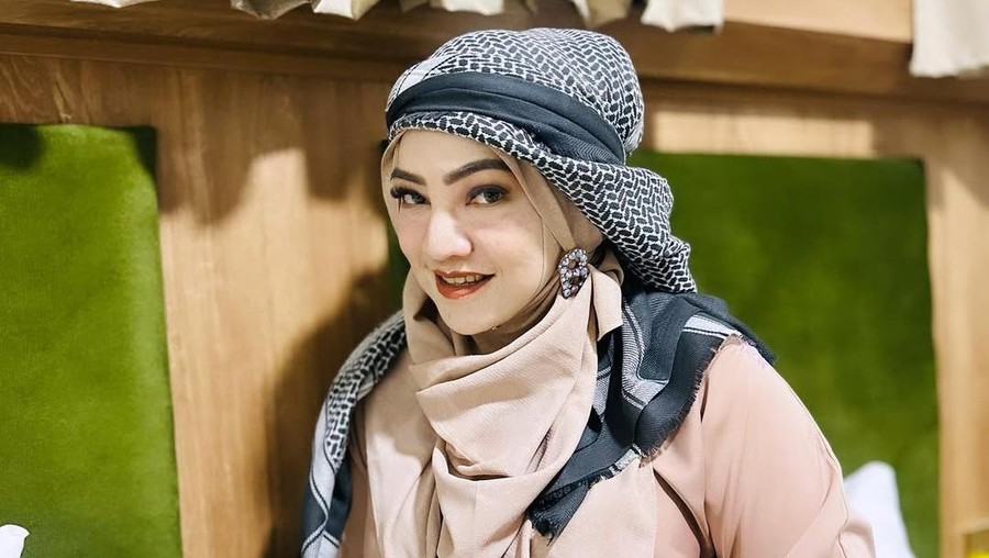 Deretan Artis Pernah Coba Totok Sirih Ferizka Utami yang Jadi Kontroversi