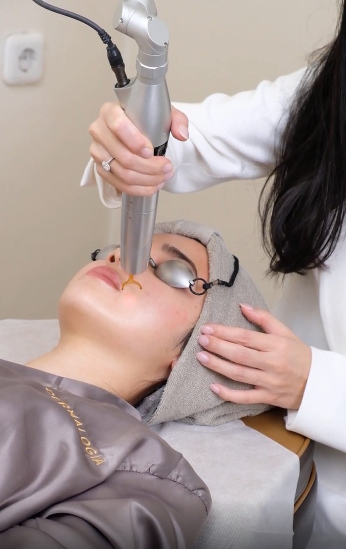 Rangkaian perawatan Pre-Wedding Syifa Hadju di Dermalogia