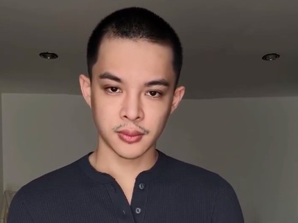 Potret Terbaru Rey Mbayang Usai Akui Idap Autoimun Psoriasis, Pilih Botakin Kepala