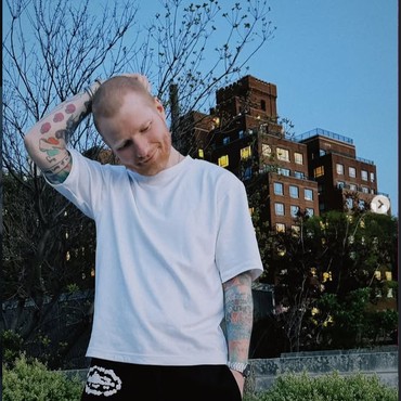 Mengenal Penyakit Herpes Zoster yang Bikin Ed Sheeran Botak