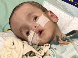 Kisah Anugerah, Bayi 6 Bulan Penderita Hidrosefalus yang Berjuang Sembuh