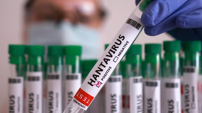 2 Kasus Dugaan Hantavirus Muncul di Spanyol, Punya Gejala Begini