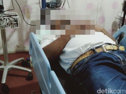Mata Disembur Ular Kobra, Warga Pamekasan Dilarikan ke RSUD