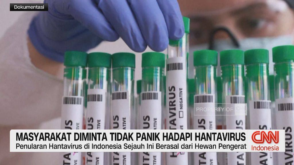 VIDEO: Masyarakat Diminta Tidak Panik Hadapi Hantavirus