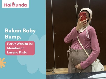 Bukan Baby Bump, Perut Perempuan Ini Membesar karena Kista
