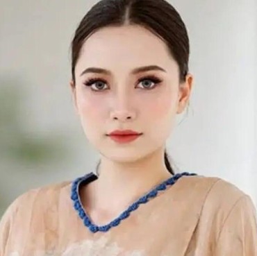 Rumor Model Ansy Jan De Vries Jadi Korban Begal Ternyata Hoaks, Polisi Klarifikasi