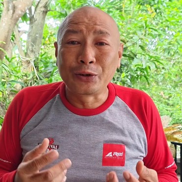 Kondisi Terkini Heru Gundul Usai Kena Semburan Bisa Kobra di Mata