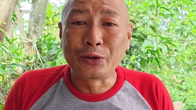 Kondisi Terkini Heru Gundul Usai Kena Semburan Bisa Kobra di Mata