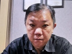 Bareskrim Buru Bos New Zone Bandar Penyedia Narkoba di Kelab Malam Medan