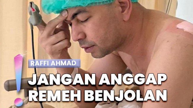 Video: Kondisi Terbaru Raffi Ahmad usai Operasi, Ungkap Benjolan di Bahu