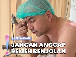 Video: Kondisi Terbaru Raffi Ahmad usai Operasi, Ungkap Benjolan di Bahu