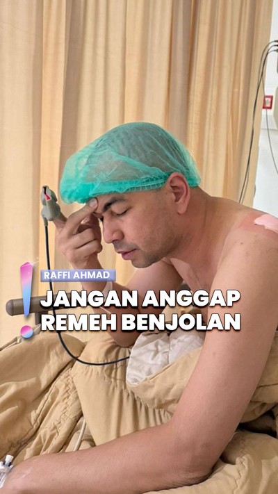 Video: Kondisi Terbaru Raffi Ahmad usai Operasi, Ungkap Benjolan di Bahu