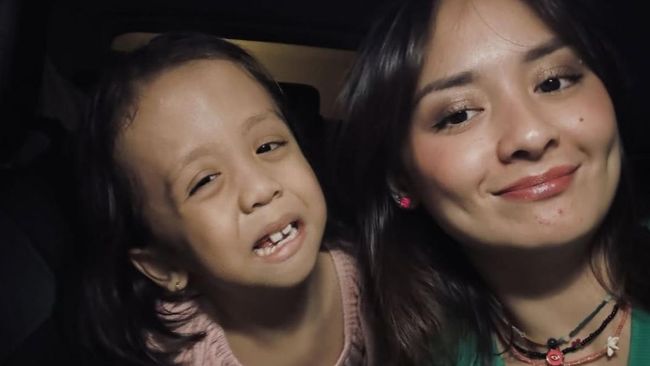 5 Potret Terbaru Ziona Anak Joanna Alexandra Yang Idap Penyakit Langka
