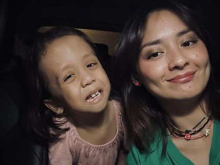 5 Potret Terbaru Ziona Anak Joanna Alexandra yang Idap Penyakit Langka