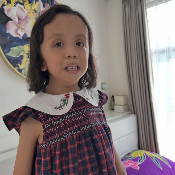 <p>Ziona lahir pada 24 Mei 2017, Bunda. Saat usianya menginjak 11 bulan, putri Joanna ini diketahui mengidap penyakit langka bernama<em> Campomelic Dysplasia</em> (CMD). Kondisi tersebut merupakan kelainan genetik yang memengaruhi perkembangan tulang, rangka tubuh, serta sistem reproduksi anak. (Foto: Instagram @joannaalexandra)</p>