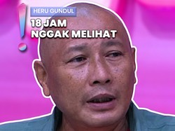 Video: Mata Heru Gundul Kena Semburan Bisa Ular Kobra: Perih Banget