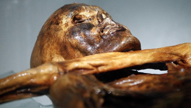 Ilmuwan Ungkap Dunia Mikroba di Tubuh Mumi Otzi Si Manusia Es