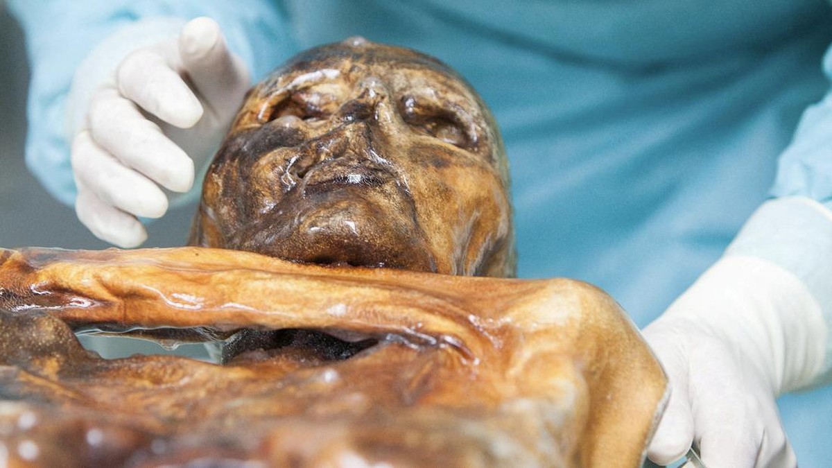 Ilmuwan Ungkap Dunia Mikroba di Tubuh Mumi Otzi Si Manusia Es