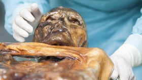 Ilmuwan Ungkap Dunia Mikroba di Tubuh Mumi Otzi Si Manusia Es