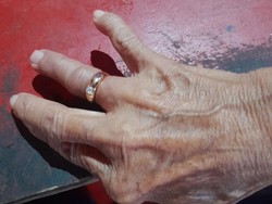 Pakai Cincin Kekecilan demi Hadiri Pesta, Nenek di Jogja Sambat ke Damkar